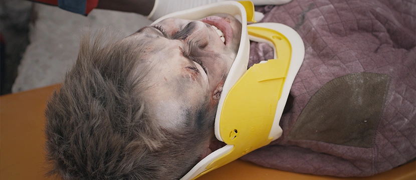 Chicago Catastrophic Injury Lawyer-image